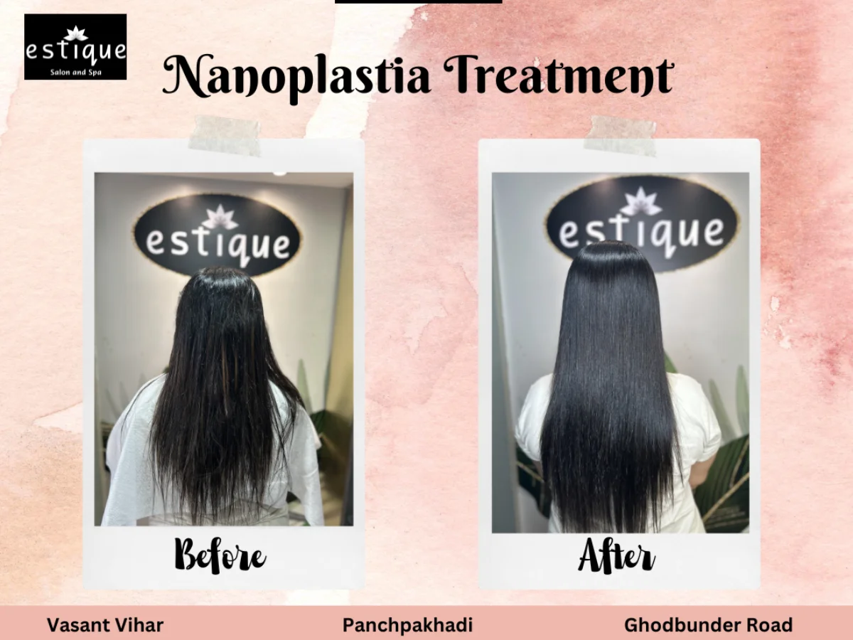 How Long Does Nanoplastia Last Expert Tips on Treatment Frequency.